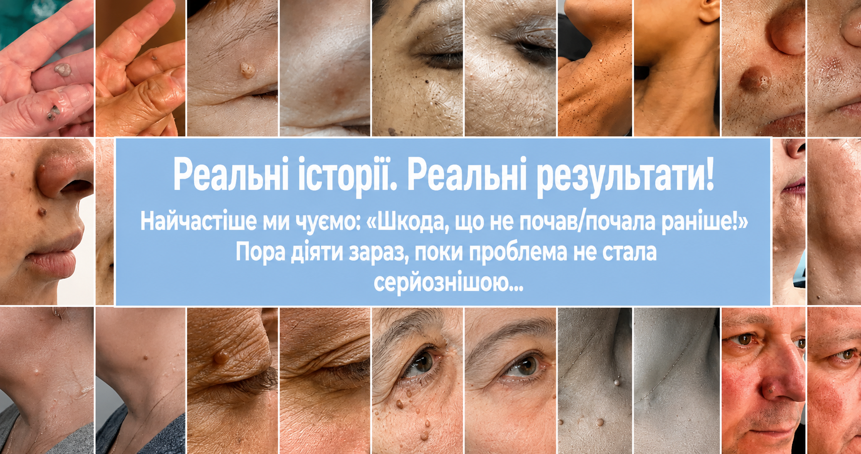 До та після використання CRYOCARE